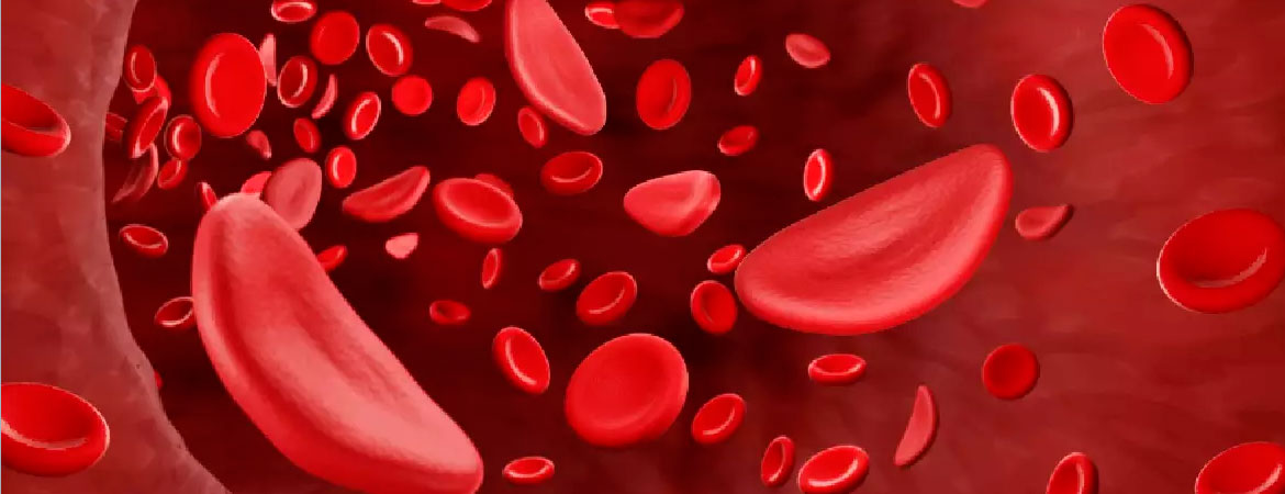 anemia-entenda